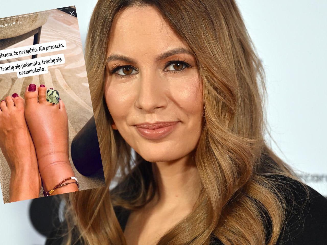 Agnieszka Hyży w gipsie po wakacyjnym potknięciu. Taki uraz to nie żarty