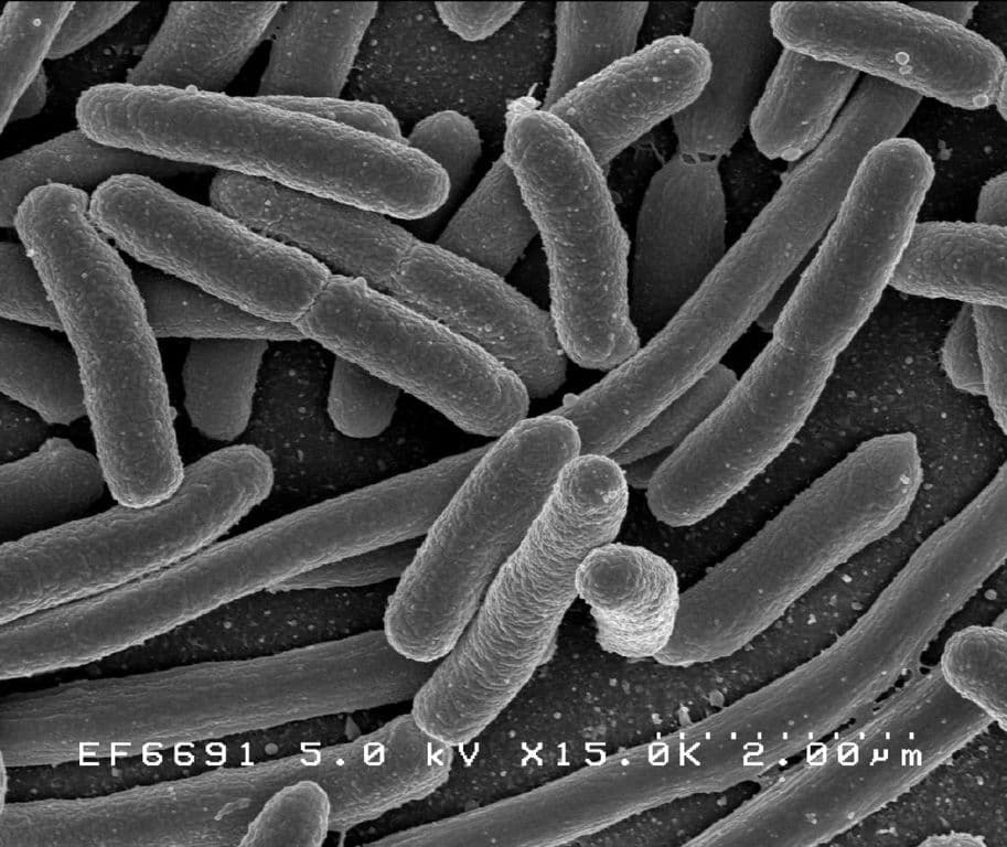 Bakterie coli w wodzie. Pilny zakaz spożywania wody dla części mieszkańców gminy Czempiń