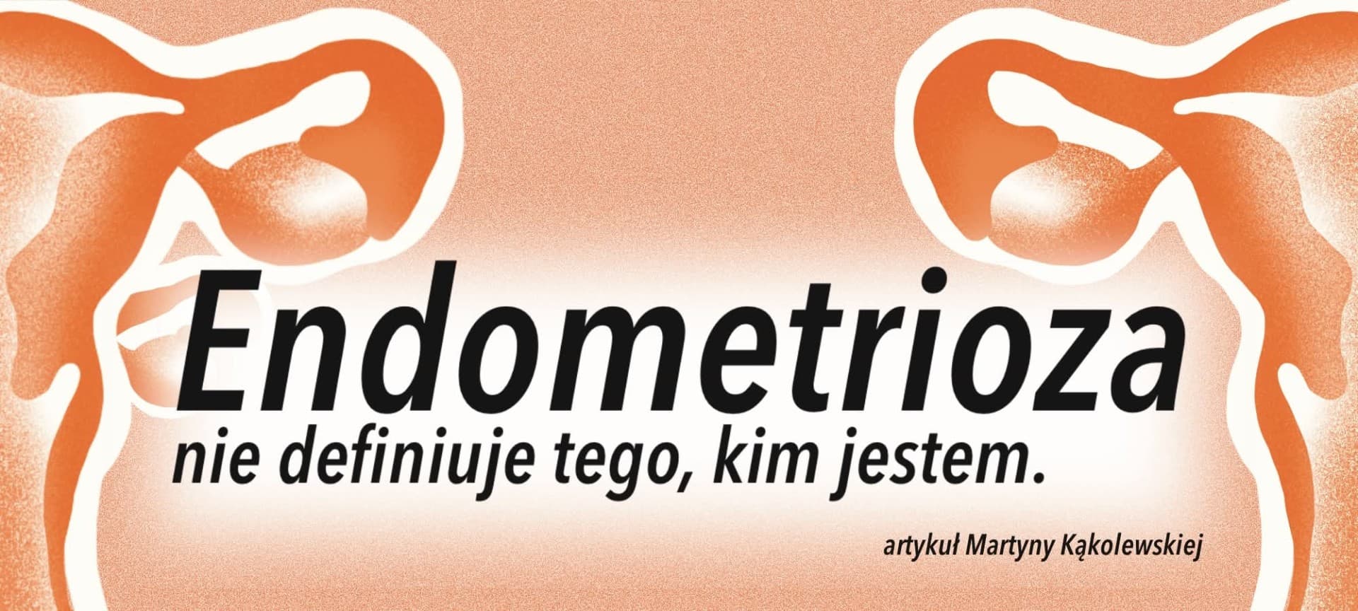Endometrioza nie definiuje tego, kim jestem
