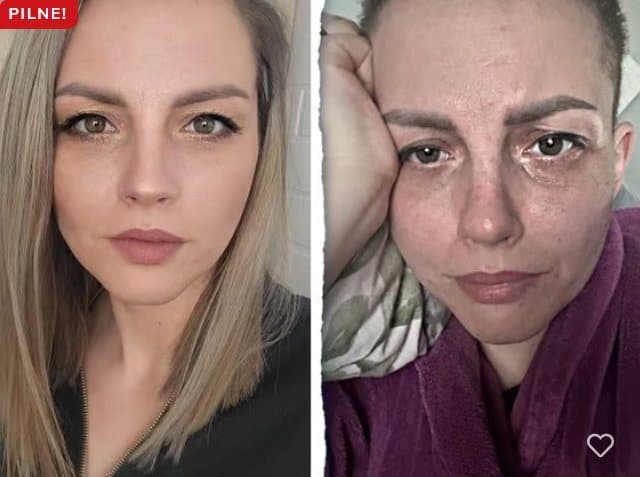 N Trwa dramatyczna walka o życie Sandry. Można pomóc Wałbrzyszance