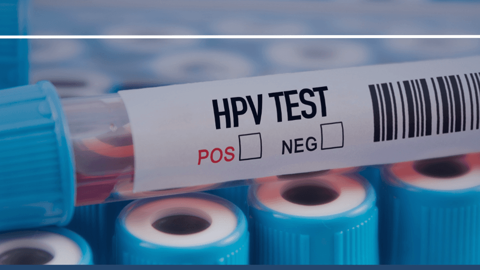 Test HPV HR w Lubuskiem. Ponad 13 tysięcy kobiet skorzystało z bezpłatnych badań na NFZ